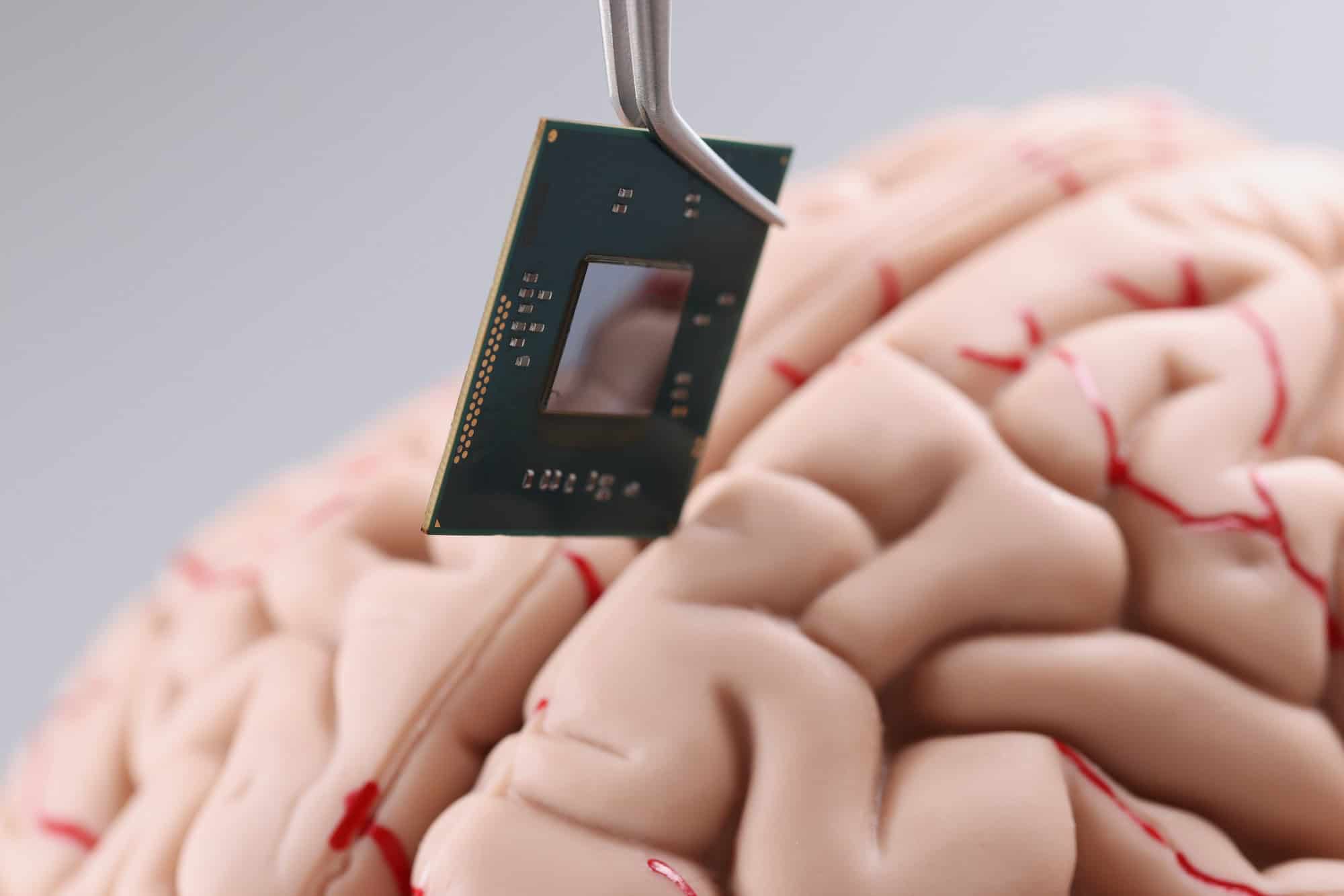 China aprova primeiro implante cerebral para uso comercial